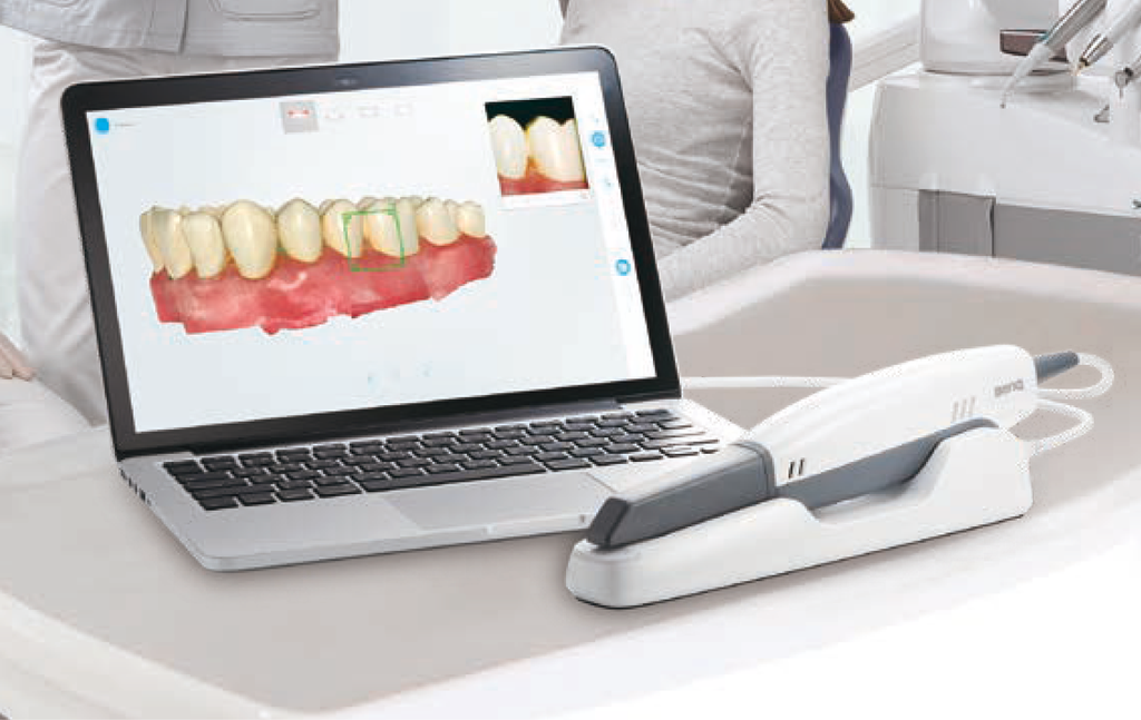 Cefla Scanner intraorale BenQ BIS-1 My-Ray - foto 1