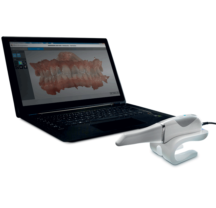 Carestream Dental CS 3600 ScanFlow - foto 1