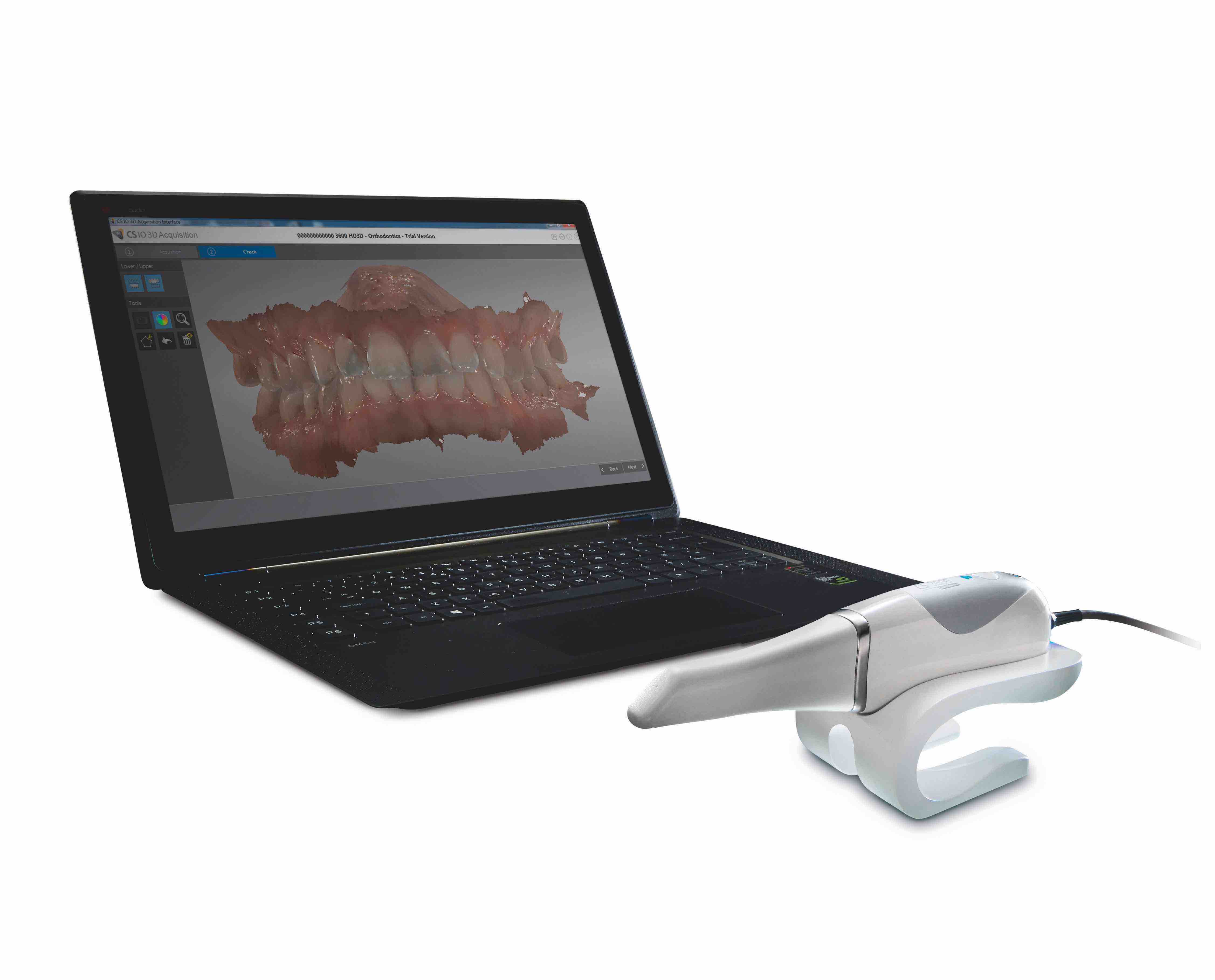 Carestream Dental CS 3600 completo di computer - foto 1