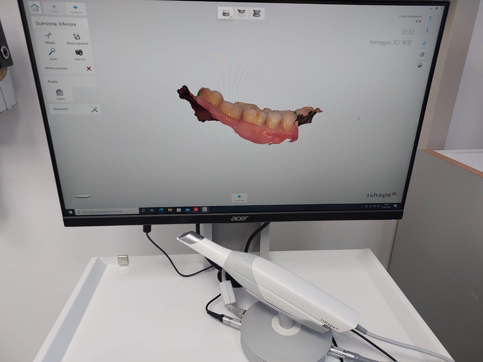 3Shape Invisalign completo di computer e 24 mesi di abbonamento - foto 1